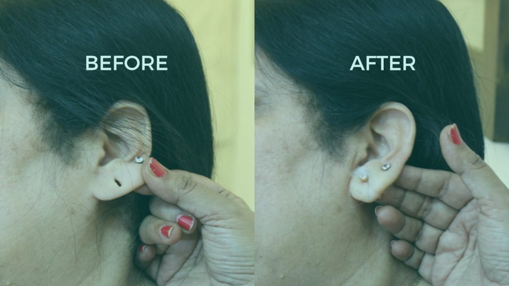 A woman in Mumbai receives an ear piercing with a needle, showcasing the delicate process of body modification.jpg
