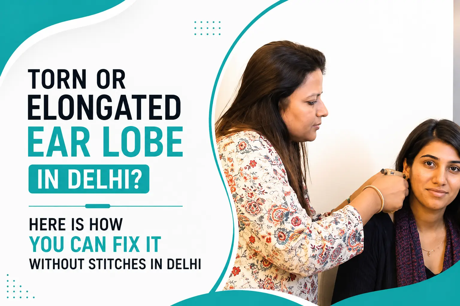 Torn or Elongated Ear Lobe in Delhi? Here Is How You Can Fix It Without Stitches